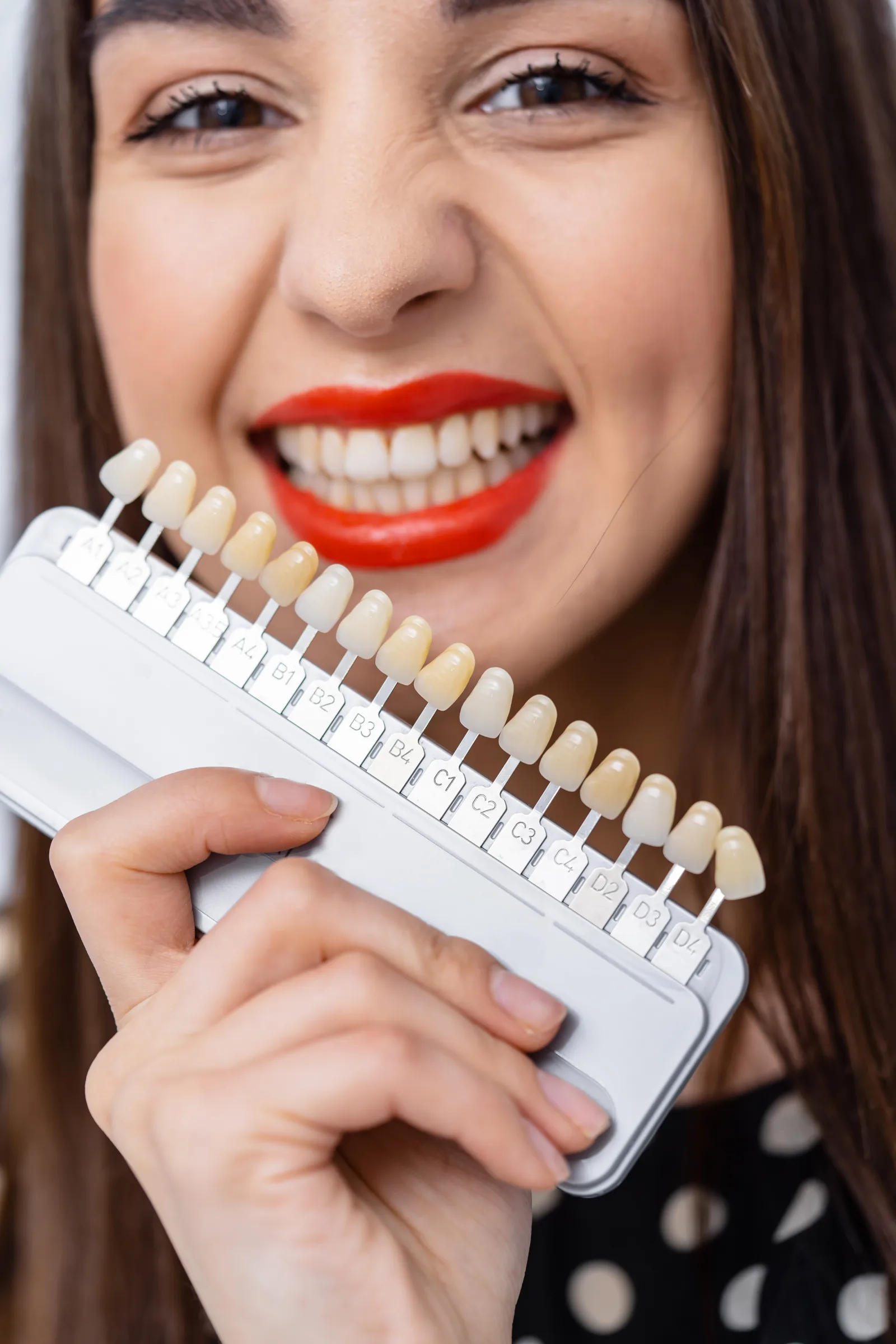 Dental Crowns & Bridges at Shine Dental Group in Merced, CA