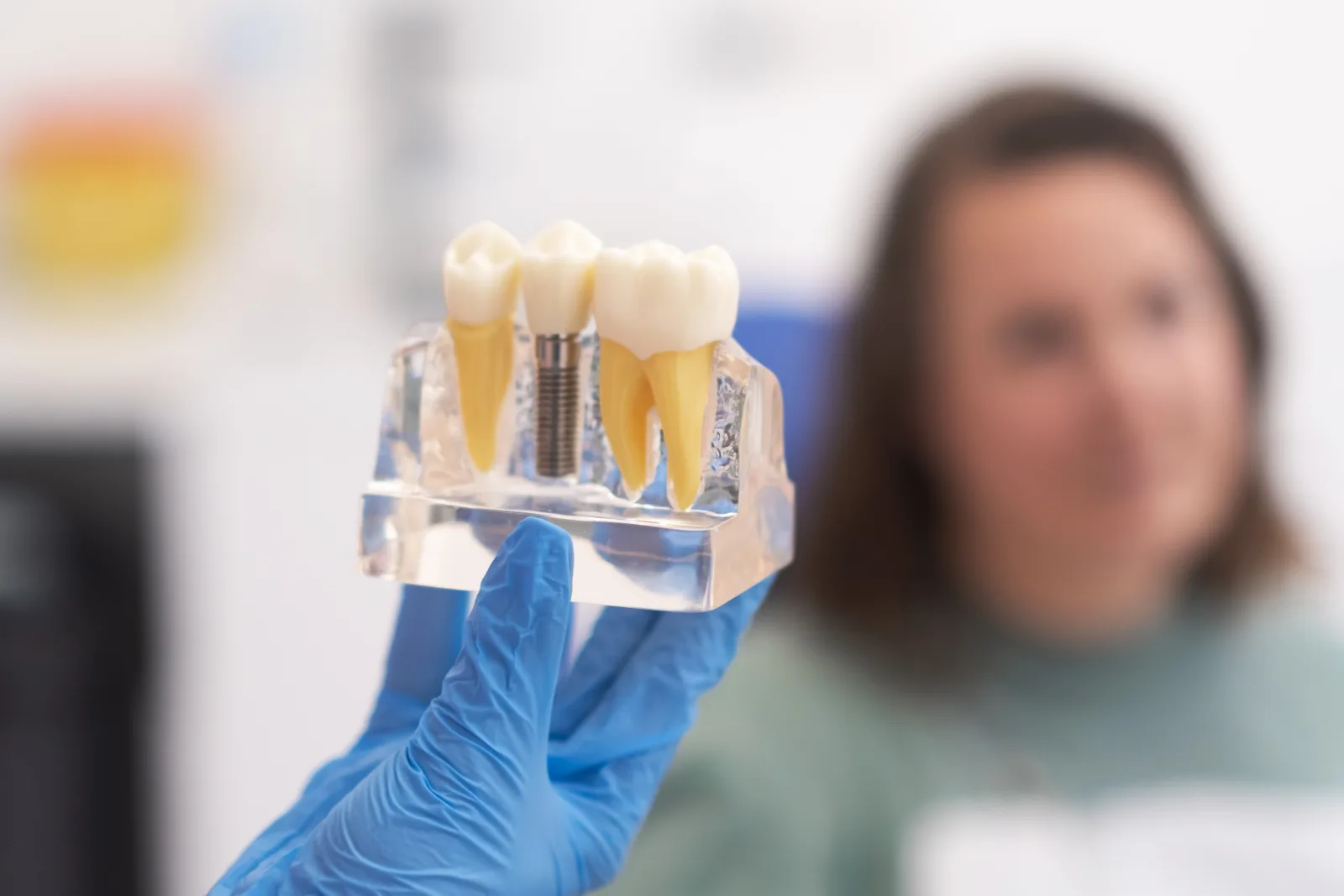 Dental Implants at Shine Dental Group in Merced, CA