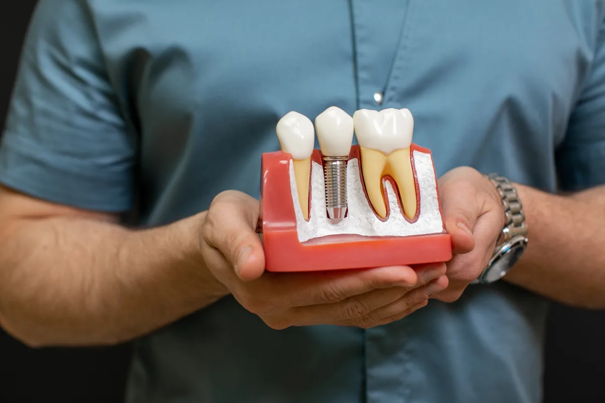 Dental Implants treatment in Merced, CA