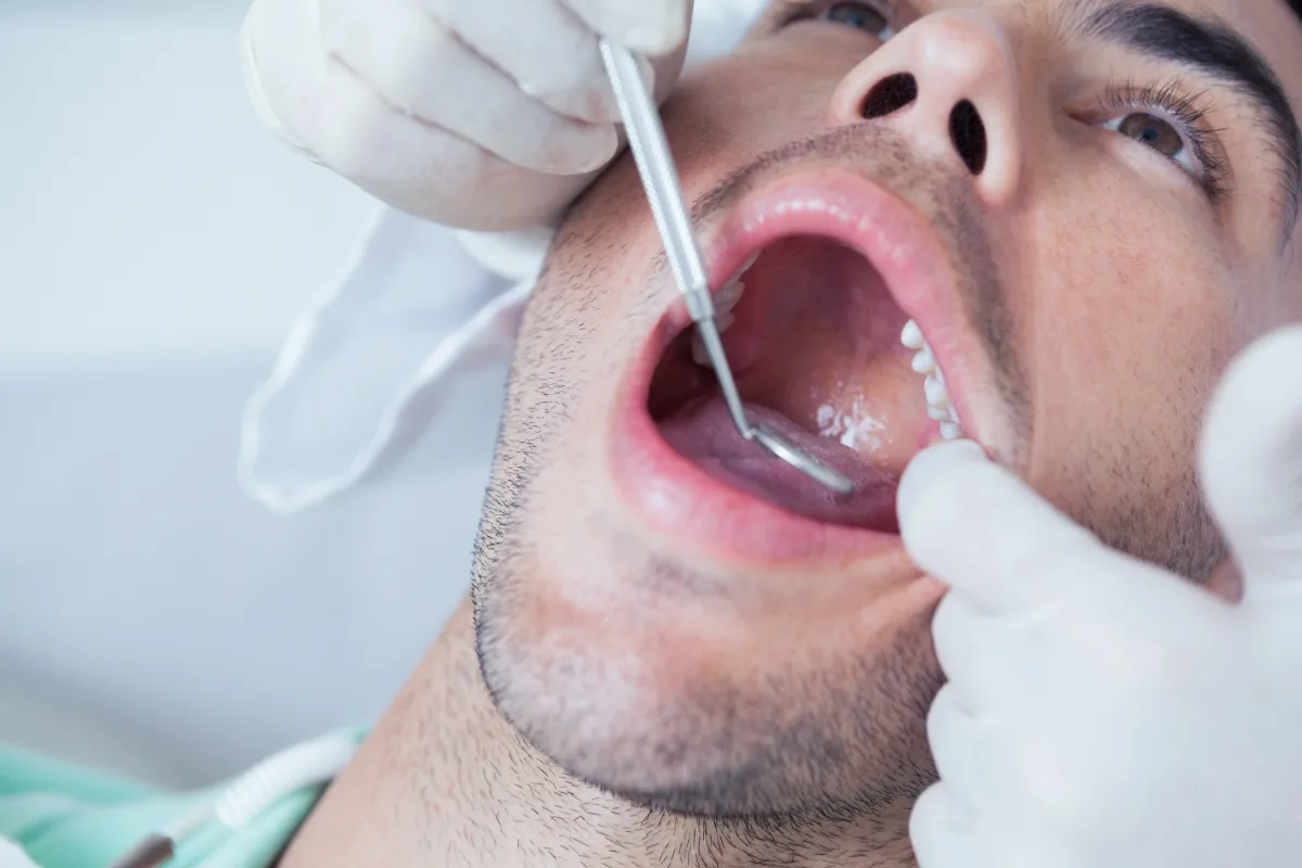 Tooth Extraction treatment in Merced, CA