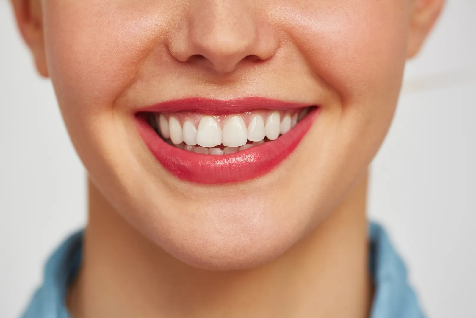 Porcelain Veneers at Shine Dental Group in Merced, CA